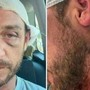 "Io aggredito a sassate in Sardegna da 30 persone perché gay", la denuncia sui social "Io aggredito a sassate in Sardegna da 30 persone perché gay", la denuncia sui social 
