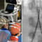 Incidente con un'acquasantiera in chiesa, bimba di 6 anni operata d'urgenza all'aorta a Bari