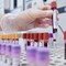 Sclerosi multipla recidivante, Ema raccomanda approvazione ocrelizumab dai 10 anni Sclerosi multipla recidivante, Ema raccomanda approvazione ocrelizumab dai 10 anni