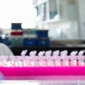 Milano, focolaio di tubercolosi all'Istituto di Medicina legale: 8 casi conclamati e 7 positivi. Indagini sull'origine del contagio Milano, focolaio di tubercolosi all'Istituto di Medicina legale: 8 casi conclamati e 7 positivi. Indagini sull'origine del contagio