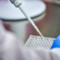 Idrosadenite suppurativa, alla Camera focus su Lea, Piano cronicità e innovazione terapeutica Idrosadenite suppurativa, alla Camera focus su Lea, Piano cronicità e innovazione terapeutica