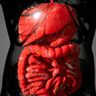 Malattia di Crohn, solo 1 paziente su 3 riceve supporto nutrizionale