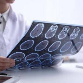 Giornata Sla, neurologi: &quot;Non resti confinata alla sperimentazione&quot;
