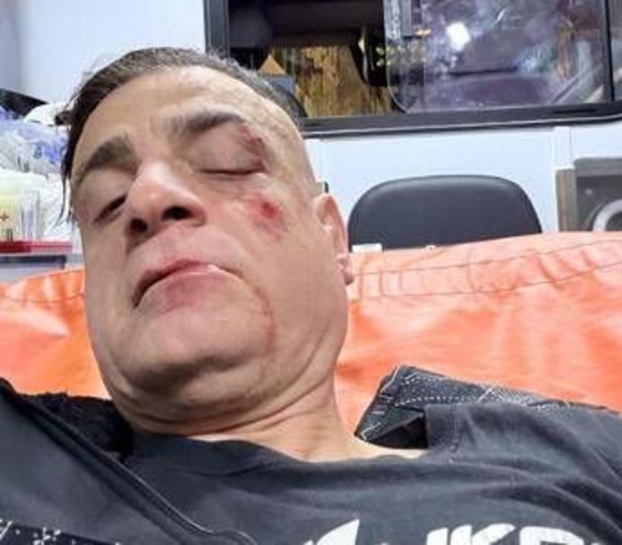 Cicalone, lo youtuber aggredito in metro a Roma: &quot;Infami veri&quot;